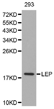 Leptin Antibody - Western blot analysis of extracts of 293 cells.