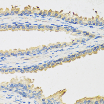 Leptin Antibody - Immunohistochemistry of paraffin-embedded human prostate.