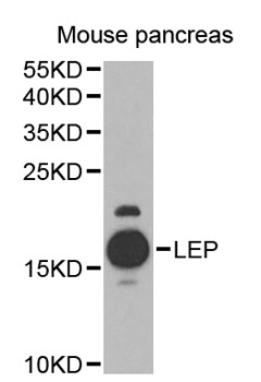 Leptin Antibody - Western blot analysis of extracts of mouse pancreas, using LEP antibody at 1:1000 dilution. The secondary antibody used was an HRP Goat Anti-Rabbit IgG (H+L) at 1:10000 dilution. Lysates were loaded 25ug per lane and 3% nonfat dry milk in TBST was used for blocking. An ECL Kit was used for detection and the exposure time was 90s.