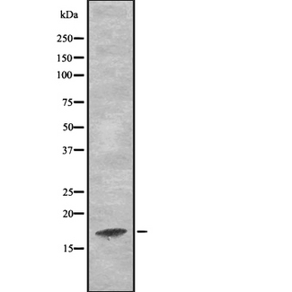 Leptin Antibody - Western blot analysis Ob using A549 whole cells lysates
