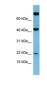 Leptin Antibody - LEP / Leptin antibody Western blot of Fetal Small Intestine lysate. This image was taken for the unconjugated form of this product. Other forms have not been tested.
