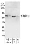 LEREPO4 / ZC3H15 Antibody - Detection of Human ZC3H15 by Western Blot. Samples: Whole cell lysate from HeLa (15 and 50 ug), 293T (T; 50 ug) and Jurkat (J; 50 ug) cells. Antibodies: Affinity purified rabbit anti-ZC3H15 antibody used for WB at 0.1 ug/ml. Detection: Chemiluminescence with an exposure time of 30 seconds.