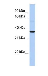 LEREPO4 / ZC3H15 Antibody - Fetal lung lysate. Antibody concentration: 1.0 ug/ml. Gel concentration: 12%.  This image was taken for the unconjugated form of this product. Other forms have not been tested.