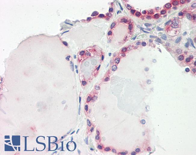 LEREPO4 / ZC3H15 Antibody - Anti-LEREPO4 / ZC3H15 antibody IHC of human thyroid. Immunohistochemistry of formalin-fixed, paraffin-embedded tissue after heat-induced antigen retrieval. Antibody dilution 2.5-5 ug/ml. This image was taken for the unconjugated form of this product. Other forms have not been tested.