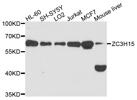LEREPO4 / ZC3H15 Antibody - Western blot analysis of extracts of various cell lines, using ZC3H15 antibody at 1:1000 dilution. The secondary antibody used was an HRP Goat Anti-Rabbit IgG (H+L) at 1:10000 dilution. Lysates were loaded 25ug per lane and 3% nonfat dry milk in TBST was used for blocking. An ECL Kit was used for detection and the exposure time was 90s.