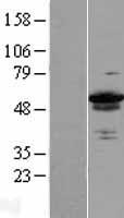 LEREPO4 / ZC3H15 Protein - Western validation with an anti-DDK antibody * L: Control HEK293 lysate R: Over-expression lysate