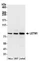 LETM1 Antibody - Detection of human LETM1 by western blot. Samples: Whole cell lysate (15 µg) from HeLa, HEK293T, and Jurkat cells prepared using NETN lysis buffer. Antibody: Affinity purified rabbit anti-LETM1 antibody used for WB at 0.1 µg/ml. Detection: Chemiluminescence with an exposure time of 30 seconds.