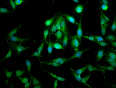 LETM1 Antibody - Immunofluorescence staining of Hela cells at a dilution of 1:100, counter-stained with DAPI. The cells were fixed in 4% formaldehyde, permeabilized using 0.2% Triton X-100 and blocked in 10% normal Goat Serum. The cells were then incubated with the antibody overnight at 4 °C.The secondary antibody was Alexa Fluor 488-congugated AffiniPure Goat Anti-Rabbit IgG (H+L) .