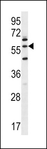 LETM2 Antibody - LETM2 Antibody western blot of NCI-H460 cell line lysates (35 ug/lane). The LETM2 antibody detected the LETM2 protein (arrow).