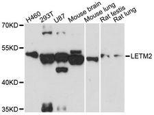 LETM2 Antibody - Western blot analysis of extracts of various cell lines, using LETM2 antibody at 1:3000 dilution. The secondary antibody used was an HRP Goat Anti-Rabbit IgG (H+L) at 1:10000 dilution. Lysates were loaded 25ug per lane and 3% nonfat dry milk in TBST was used for blocking. An ECL Kit was used for detection and the exposure time was 60s.