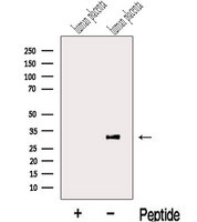 LETM2 Antibody - Western blot analysis of extracts of human placenta tissue using LETM2 antibody. The lane on the left was treated with blocking peptide.