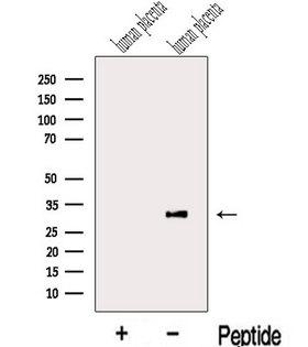 LETM2 Antibody - Western blot analysis of extracts of human placenta tissue using LETM2 antibody. The lane on the left was treated with blocking peptide.