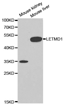 LETMD1 / HCCR1 Antibody - Western blot analysis of extracts of various cell lines, using LETMD1 antibody.
