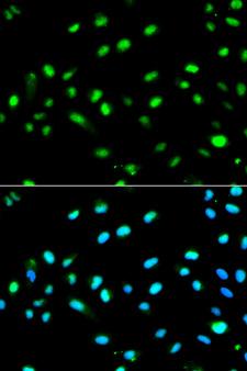 LETMD1 / HCCR1 Antibody - Immunofluorescence analysis of MCF7 cell using LETMD1 antibody. Blue: DAPI for nuclear staining.