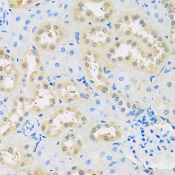 LETMD1 / HCCR1 Antibody - Immunohistochemistry of paraffin-embedded rat kidney tissue.