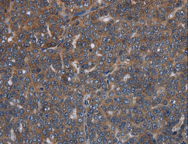 LETMD1 / HCCR1 Antibody - Immunohistochemistry of paraffin-embedded Human brain using LETMD1 Polyclonal Antibody at dilution of 1:30.