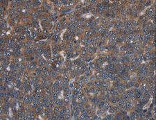 LETMD1 / HCCR1 Antibody - Immunohistochemistry of paraffin-embedded Human brain using LETMD1 Polyclonal Antibody at dilution of 1:30.