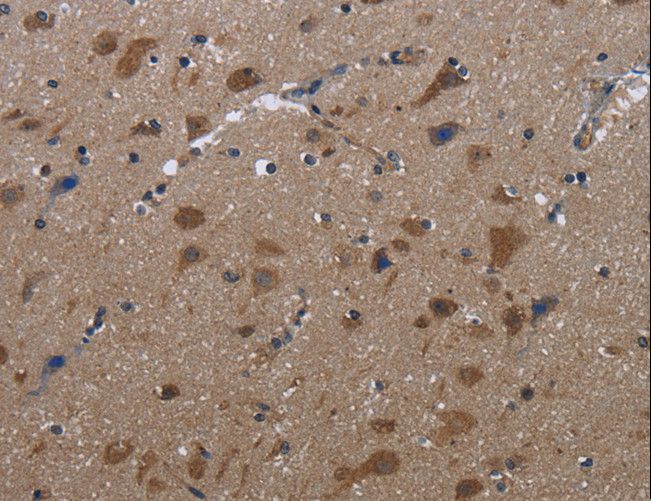 LETMD1 / HCCR1 Antibody - Immunohistochemistry of paraffin-embedded Human brain using LETMD1 Polyclonal Antibody at dilution of 1:30.