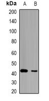 LETMD1 / HCCR1 Antibody - Western blot analysis of HCCR-1 expression in mouse kidney (A); mouse liver (B) whole cell lysates.