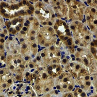 LETMD1 / HCCR1 Antibody - Immunohistochemical analysis of HCCR-1 staining in human kidney formalin fixed paraffin embedded tissue section. The section was pre-treated using heat mediated antigen retrieval with sodium citrate buffer (pH 6.0). The section was then incubated with the antibody at room temperature and detected using an HRP conjugated compact polymer system. DAB was used as the chromogen. The section was then counterstained with hematoxylin and mounted with DPX.