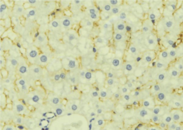 LETMD1 / HCCR1 Antibody - 1:100 staining mouse liver tissue by IHC-P. The sample was formaldehyde fixed and a heat mediated antigen retrieval step in citrate buffer was performed. The sample was then blocked and incubated with the antibody for 1.5 hours at 22°C. An HRP conjugated goat anti-rabbit antibody was used as the secondary.