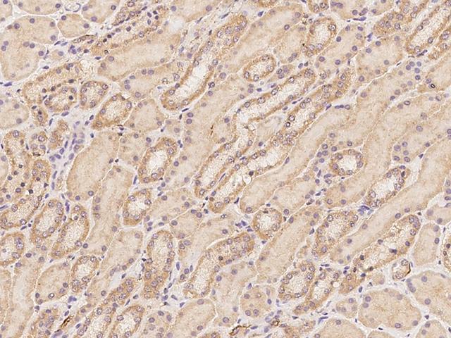 LETMD1 / HCCR1 Antibody - Immunochemical staining of human LETMD1 in human kidney with rabbit polyclonal antibody at 1:100 dilution, formalin-fixed paraffin embedded sections.