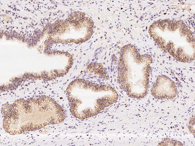LETMD1 / HCCR1 Antibody - Immunochemical staining of human LETMD1 in human prostate with rabbit polyclonal antibody at 1:100 dilution, formalin-fixed paraffin embedded sections.