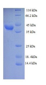 DLD / Diaphorase / E3 Protein