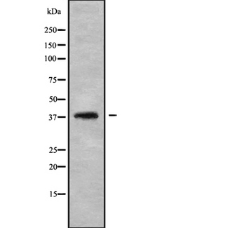 Leukotriene B4 Receptor / BLT1 Antibody - Western blot analysis of LT4R1 using HepG2 whole cells lysates