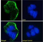 Lewis y / BG8 / CD174 Antibody - IF staining of Caco-2 cells.