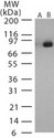 LF / Lethal Factor Antibody - Western blot of Anthrax LF in recombinant protein using antibody (lane B) at 1:1000 dilution. Lane A shows the pre-bleed.