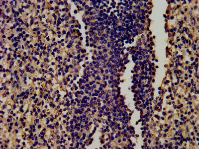 LF / LTF / Lactoferrin Antibody - IHC image of LTF Antibody diluted at 1:450 and staining in paraffin-embedded human spleen tissue performed on a Leica BondTM system. After dewaxing and hydration, antigen retrieval was mediated by high pressure in a citrate buffer (pH 6.0). Section was blocked with 10% normal goat serum 30min at RT. Then primary antibody (1% BSA) was incubated at 4°C overnight. The primary is detected by a biotinylated secondary antibody and visualized using an HRP conjugated SP system.