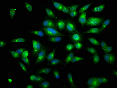 LF / LTF / Lactoferrin Antibody - Immunofluorescence staining of Hela cells with LTF Antibody at 1:150, counter-stained with DAPI. The cells were fixed in 4% formaldehyde, permeabilized using 0.2% Triton X-100 and blocked in 10% normal Goat Serum. The cells were then incubated with the antibody overnight at 4°C. The secondary antibody was Alexa Fluor 488-congugated AffiniPure Goat Anti-Rabbit IgG(H+L).