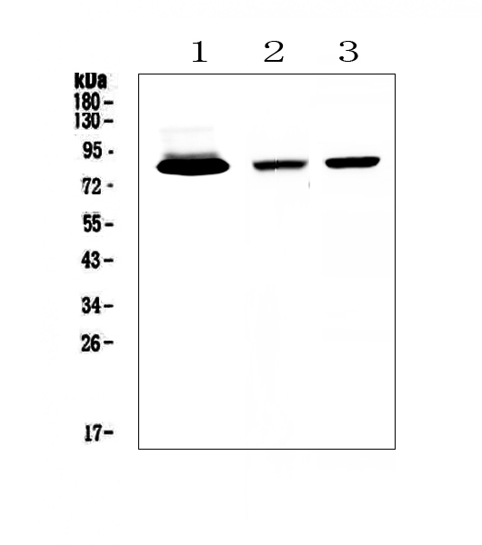 LF / LTF / Lactoferrin Antibody - Western blot analysis of Lactoferrin using anti-Lactoferrin antibody. Electrophoresis was performed on a 5-20% SDS-PAGE gel at 70V (Stacking gel) / 90V (Resolving gel) for 2-3 hours. The sample well of each lane was loaded with 50ug of sample under reducing conditions. Lane 1: human placenta tissue lysates,Lane 2: rat spleen tissue lysates,Lane 3: mouse spleen tissue lysates. After Electrophoresis, proteins were transferred to a Nitrocellulose membrane at 150mA for 50-90 minutes. Blocked the membrane with 5% Non-fat Milk/ TBS for 1.5 hour at RT. The membrane was incubated with rabbit anti-Lactoferrin antigen affinity purified polyclonal antibody at 0.5 µg/mL overnight at 4°C, then washed with TBS-0.1% Tween 3 times with 5 minutes each and probed with a goat anti-rabbit IgG-HRP secondary antibody at a dilution of 1:10000 for 1.5 hour at RT. The signal is developed using an Enhanced Chemiluminescent detection (ECL) kit with Tanon 5200 system. A specific band was detected for Lactoferrin at approximately 85KD. The expected band size for Lactoferrin is at 78KD.