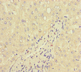 LF / LTF / Lactoferrin Antibody - Immunohistochemistry of paraffin-embedded human liver tissue at dilution of 1:100