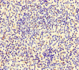 LF / LTF / Lactoferrin Antibody - Immunohistochemistry of paraffin-embedded human spleen tissue at dilution of 1:100