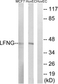 LFNG / Lunatic Fringe Antibody - Western blot analysis of lysates from HUVEC and MCF-7 cells, using LFNG Antibody. The lane on the right is blocked with the synthesized peptide.