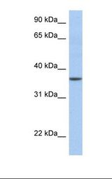 LFNG / Lunatic Fringe Antibody - Fetal muscle lysate. Antibody concentration: 1.0 ug/ml. Gel concentration: 12%.  This image was taken for the unconjugated form of this product. Other forms have not been tested.