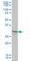 LFNG / Lunatic Fringe Antibody - LFNG monoclonal antibody (M01), clone 2D10-3C11 Western Blot analysis of LFNG expression in HL-60.