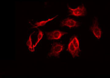 LFNG / Lunatic Fringe Antibody - Staining HuvEc cells by IF/ICC. The samples were fixed with PFA and permeabilized in 0.1% Triton X-100, then blocked in 10% serum for 45 min at 25°C. The primary antibody was diluted at 1:200 and incubated with the sample for 1 hour at 37°C. An Alexa Fluor 594 conjugated goat anti-rabbit IgG (H+L) Ab, diluted at 1/600, was used as the secondary antibody.