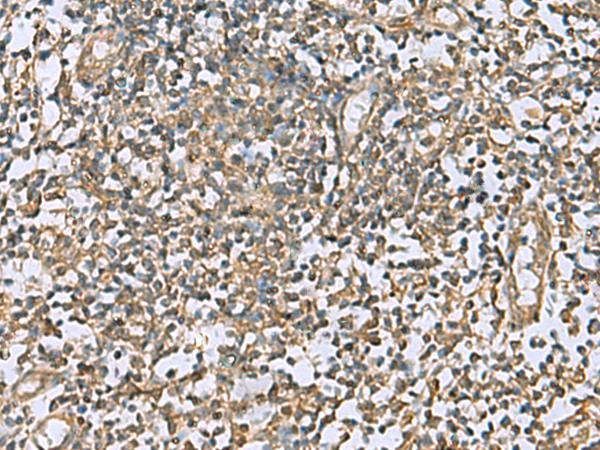 LFNG / Lunatic Fringe Antibody - Immunohistochemistry of paraffin-embedded Human tonsil tissue  using LFNG Polyclonal Antibody at dilution of 1:60(×200)