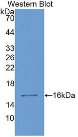 LGALS1 / Galectin 1 Antibody