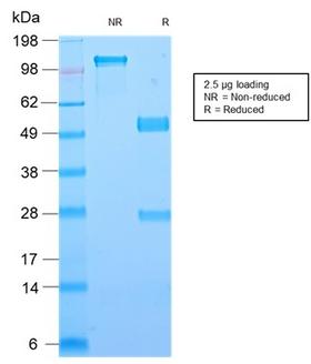 LGALS1 / Galectin 1 Antibody - SDS-PAGE Analysis Purified Galectin-1 Rabbit Recombinant Monoclonal Antibody (GAL1/2499R). Confirmation of Purity and Integrity of Antibody.