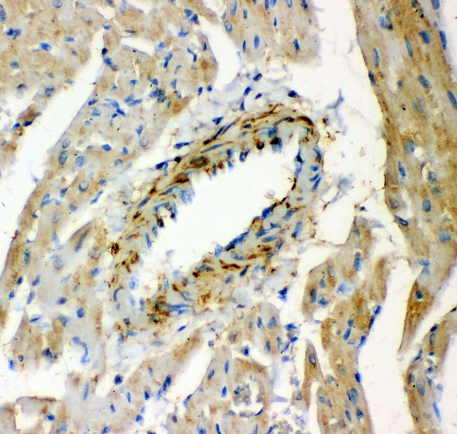 LGALS1 / Galectin 1 Antibody - Galectin1 antibody IHC-paraffin: Rat Cardiac Muscle Tissue.