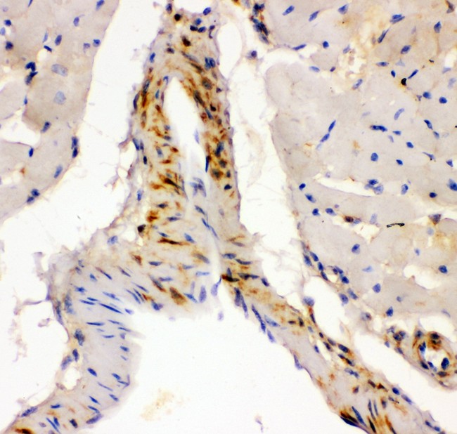 LGALS1 / Galectin 1 Antibody - Galectin1 antibody IHC-paraffin: Mouse Cardiac Muscle Tissue.