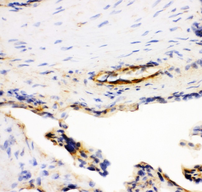 LGALS1 / Galectin 1 Antibody - Galectin1 antibody IHC-frozen: Human Placenta Tissue.