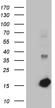 LGALS1 / Galectin 1 Antibody - HEK293T cells were transfected with the pCMV6-ENTRY control. (Left lane) or pCMV6-ENTRY LGALS1. (Right lane) cDNA for 48 hrs and lysed. Equivalent amounts of cell lysates. (5 ug per lane) were separated by SDS-PAGE and immunoblotted with anti-LGALS1. (1:2000)