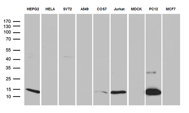 LGALS1 / Galectin 1 Antibody - Western blot analysis of extracts. (35ug) from 9 different cell lines by using anti-LGALS1 monoclonal antibody. (1:500)