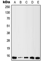 LGALS1 / Galectin 1 Antibody - Western blot analysis of Galectin 1 expression in HeLa (A); HepG2 (B); Raw264.7 (C); H9C2 (D); Human liver (E) whole cell lysates.