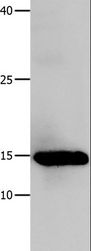 LGALS1 / Galectin 1 Antibody - Western blot analysis of Human fetal muscle tissue, using LGALS1 Polyclonal Antibody at dilution of 1:500.